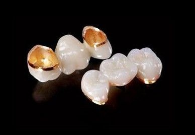 correct usage of porcelain teeth on patient