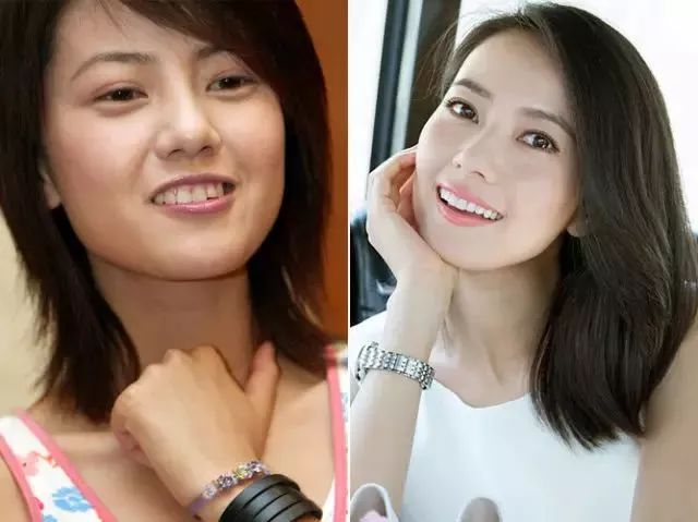 figure dental zirconia teeth for cosmetic