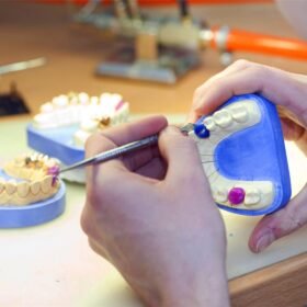 denture made in dental laboratory
