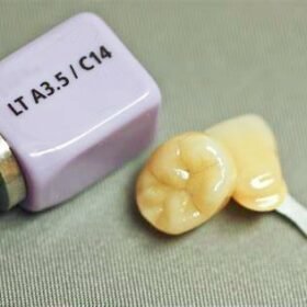 CAD CAM SIRONA CEREC DISILICATE LITHIUM BLOCK IN DENTISTRY