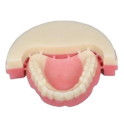 CAD/CAM Full denture prosthesis application