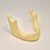 implant drilling train on mandible