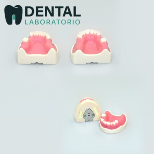 missing tooth model with magnet plate