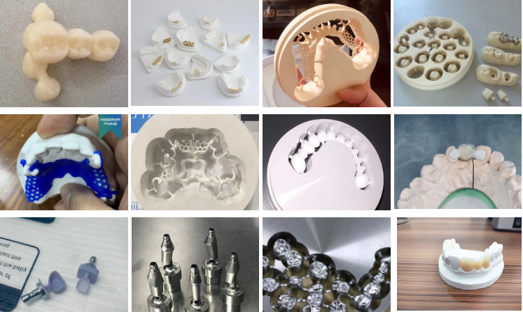 cad cam milling restoration