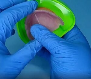 precision border molding for complete denture