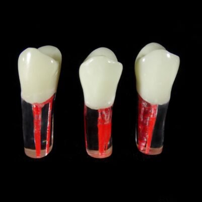 open pulped root canal in vitro